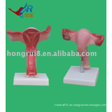 Der Uterus vergrößern Modell, Uterus Modell
